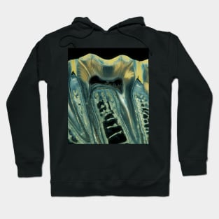 Tooth, light micrograph (C028/6621) Hoodie